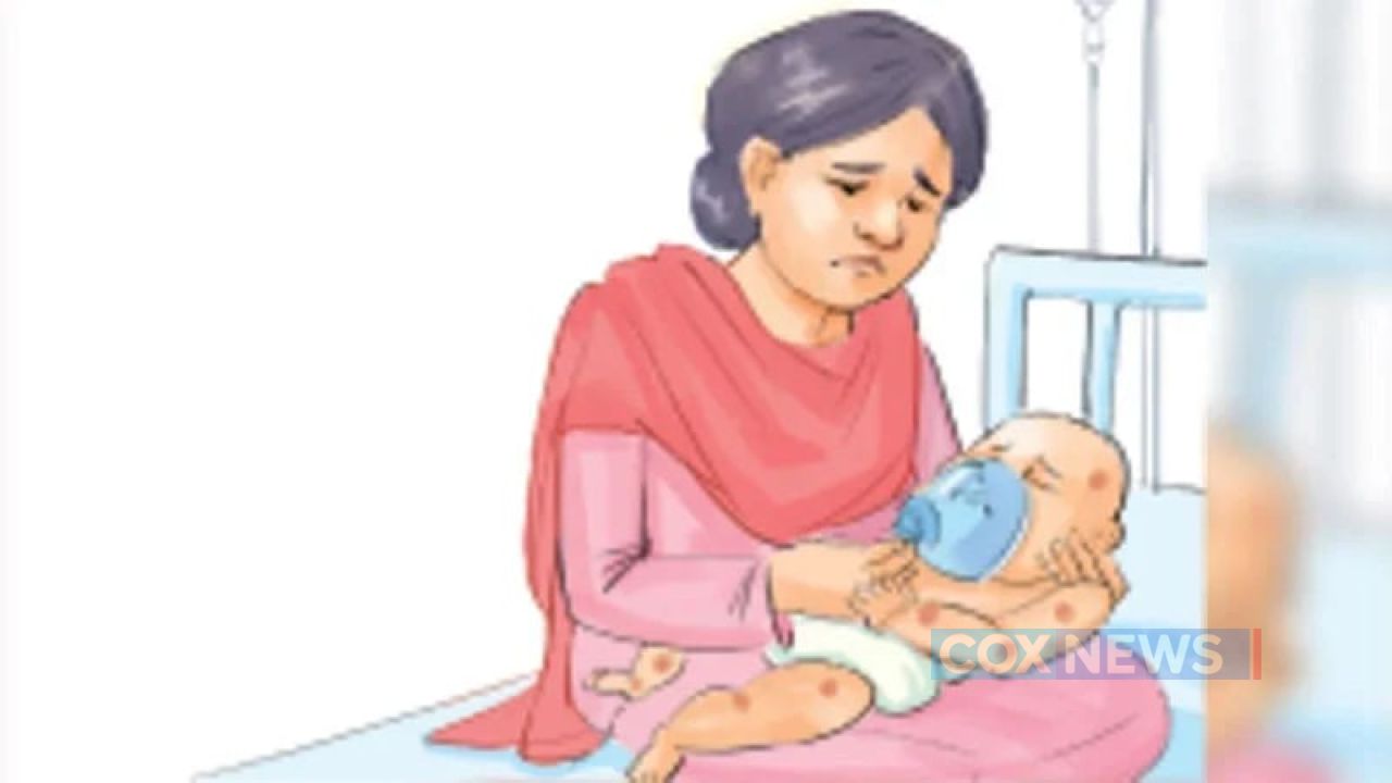 হামের উপসর্গে আরও দুই শিশুর মৃত্যু